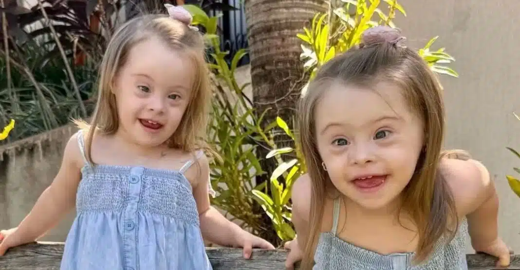 “Senti amor e felicidade ao tê-las nos meus braços”, diz mãe que descobriu só no parto que suas gêmeas tinham Down
