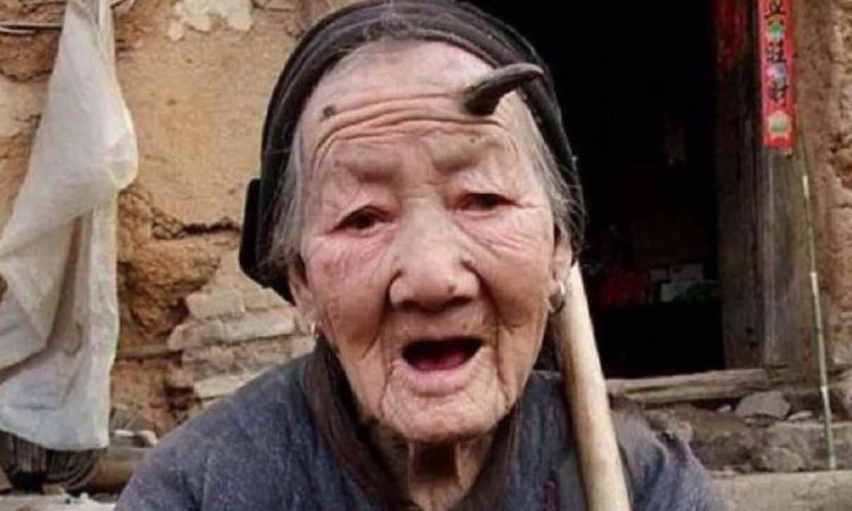 pensarcontemporaneo.com - Caso raríssimo: Chinesa de 107 anos viraliza ao mostrar chifre de 10 cm crescendo na testa - veja imagens